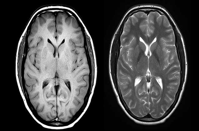 Una resonancia para ver cómo compra tu cerebro